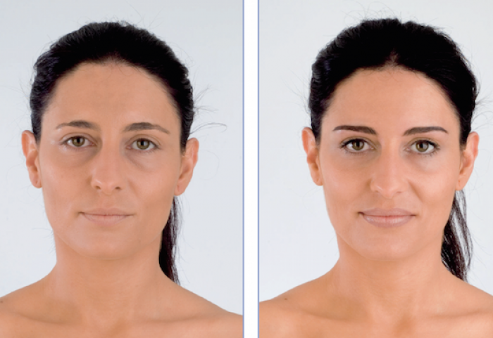 micropigmentacion.-maquillaje-semipermanente