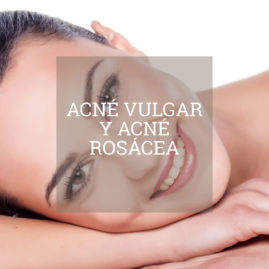tratamiento-acne