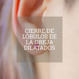 cierre-lobulos-oreja