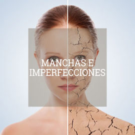 manchas-imperfecciones