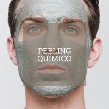 peeling-quimico