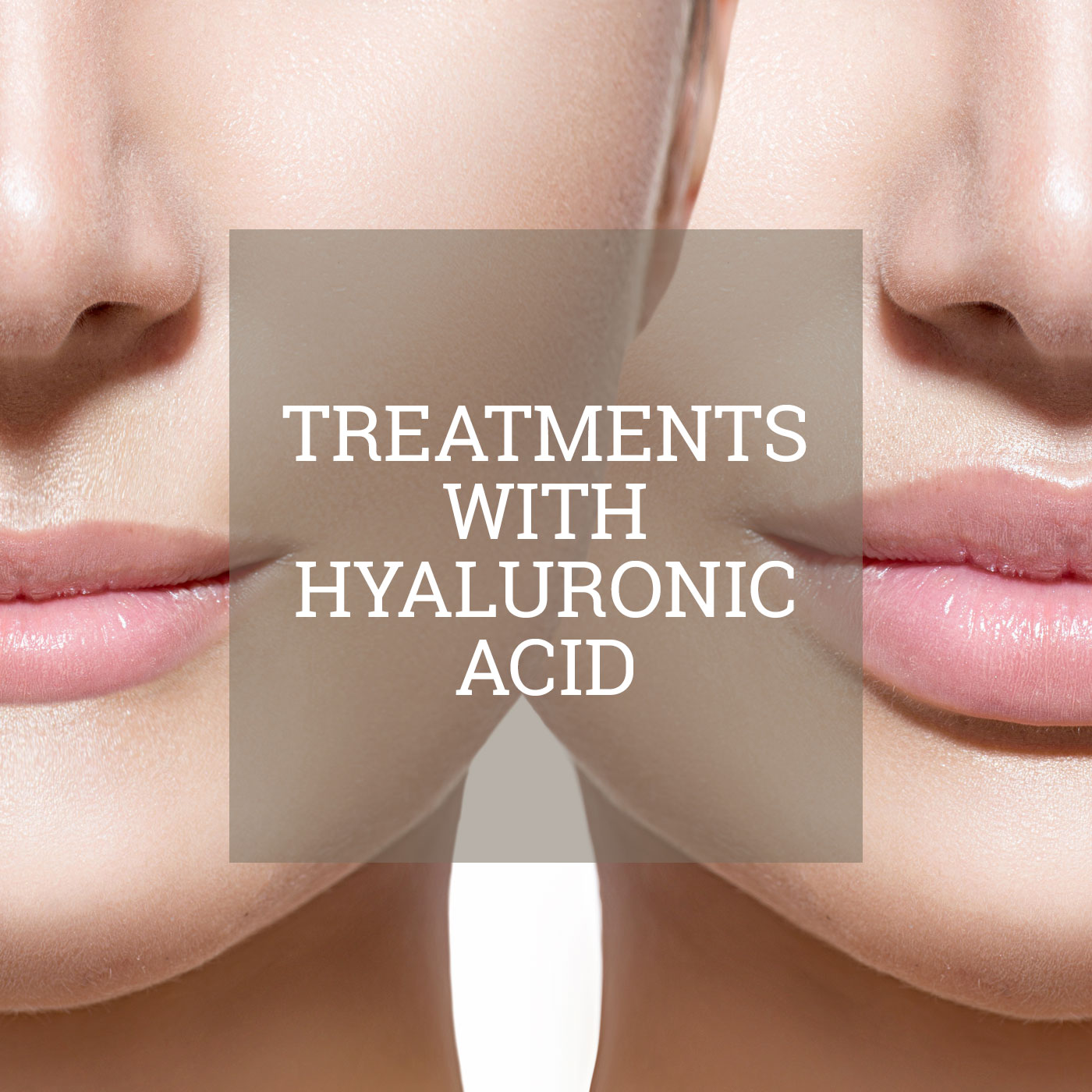 Treatments With Hyaluronic Acid - Epidermos Instituto De Dermoestética